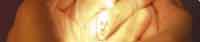 img-dx