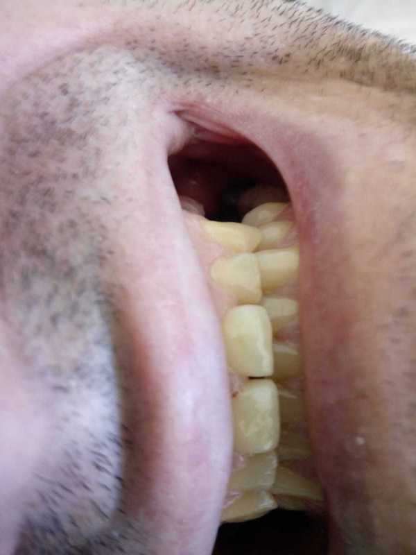 img-dx