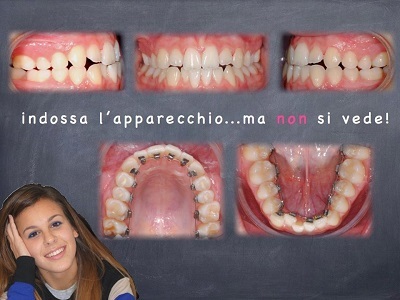 img-dx